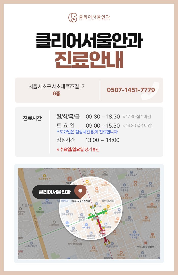 스마일라식비용